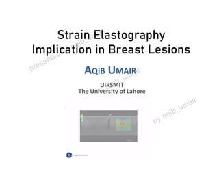 Strain Elastography
Implication in Breast Lesions
AQIB UMAIR
UIRSMITUIRSMIT
The University of Lahore
 