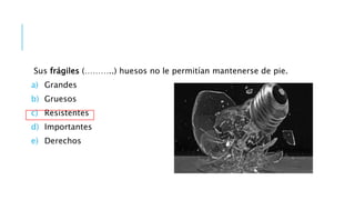 Sus frágiles (………..) huesos no le permitían mantenerse de pie.
a) Grandes
b) Gruesos
c) Resistentes
d) Importantes
e) Derechos
 