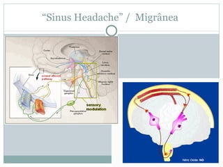 “ Sinus Headache” /  Migrânea  