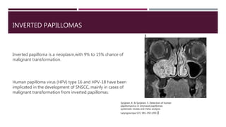 INVERTED PAPILLOMAS
Inverted papilloma is a neoplasm,with 9% to 15% chance of
malignant transformation.
Human papilloma virus (HPV) type 16 and HPV-18 have been
implicated in the development of SNSCC, mainly in cases of
malignant transformation from inverted papillomas.
Syrjänen, K. & Syrjänen, S. Detection of human
papillomavirus in sinonasal papillomas:
systematic review and meta-analysis.
Laryngoscope 123, 181–192 (2013)
 