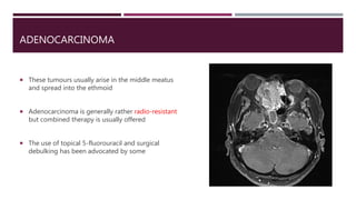 ADENOCARCINOMA
 These tumours usually arise in the middle meatus
and spread into the ethmoid
 Adenocarcinoma is generally rather radio-resistant
but combined therapy is usually offered
 The use of topical 5-fluorouracil and surgical
debulking has been advocated by some
 