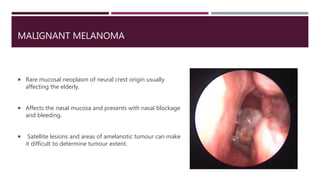 MALIGNANT MELANOMA
 Rare mucosal neoplasm of neural crest origin usually
affecting the elderly.
 Affects the nasal mucosa and presents with nasal blockage
and bleeding.
 Satellite lesions and areas of amelanotic tumour can make
it difficult to determine tumour extent.
 