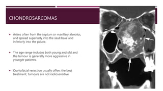CHONDROSARCOMAS
 Arises often from the septum or maxillary alveolus,
and spread superiorly into the skull base and
inferiorly into the palate.
 The age range includes both young and old and
the tumour is generally more aggressive in
younger patients.
 Craniofacial resection usually offers the best
treatment, tumours are not radiosensitive
 