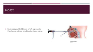 BIOPSY
 Endoscopy guided biopsy which represents
the disease without breaking the tissue plane.
 
