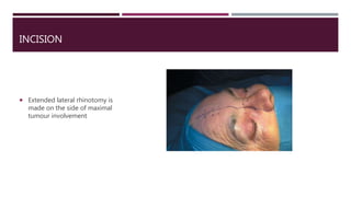 INCISION
 Extended lateral rhinotomy is
made on the side of maximal
tumour involvement
 