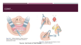 CONT…
Source- text book of Stell Maran
 