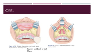 CONT..
Source- text book of Stell
Maran
 