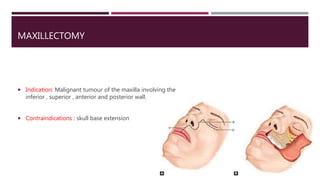 MAXILLECTOMY
 Indication: Malignant tumour of the maxilla involving the
inferior , superior , anterior and posterior wall.
 Contraindications : skull base extension
 