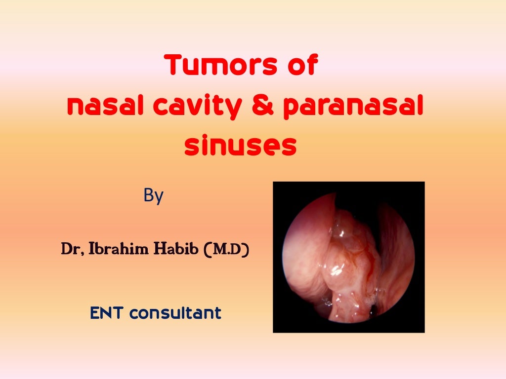 Tumours of nasal cavity & paranasal sinuses
