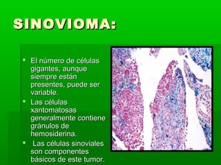 SSIINNOOVVIIOOMMAA:: 
 EEll nnúúmmeerroo ddee ccéélluullaass 
ggiiggaanntteess,, aauunnqquuee 
ssiieemmpprree eessttáánn 
pprreesseenntteess,, ppuueeddee sseerr 
vvaarriiaabbllee.. 
 LLaass ccéélluullaass 
xxaannttoommaattoossaass 
ggeenneerraallmmeennttee ccoonnttiieennee 
ggrráánnuullooss ddee 
hheemmoossiiddeerriinnaa.. 
 LLaass ccéélluullaass ssiinnoovviiaalleess 
ssoonn ccoommppoonneenntteess 
bbáássiiccooss ddee eessttee ttuummoorr.. 
 