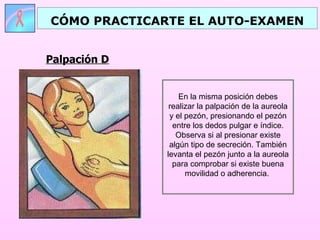 Palpación D CÓMO PRACTICARTE EL AUTO-EXAMEN En la misma posición debes realizar la palpación de la aureola y el pezón, presionando el pezón entre los dedos pulgar e índice. Observa si al presionar existe algún tipo de secreción. También levanta el pezón junto a la aureola para comprobar si existe buena movilidad o adherencia.  