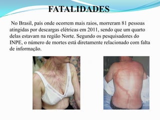FATALIDADES
No Brasil, país onde ocorrem mais raios, morreram 81 pessoas
atingidas por descargas elétricas em 2011, sendo que um quarto
delas estavam na região Norte. Segundo os pesquisadores do
INPE, o número de mortes está diretamente relacionado com falta
de informação.

 