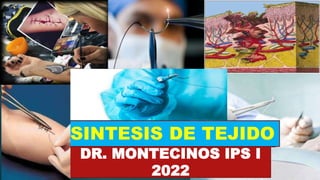 SINTESIS DE TEJIDO
DR. MONTECINOS IPS I
2022
 
