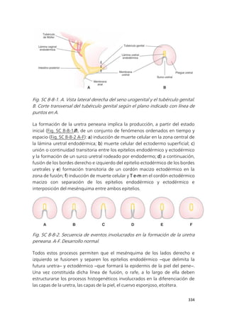 334
Fig. SC 8-8-1. A. Vista lateral derecha del seno urogenital y el tubérculo genital.
B. Corte transversal del tubérculo genital según el plano indicado con línea de
puntos en A.
La formación de la uretra peneana implica la producción, a partir del estado
inicial (Fig. SC 8-8-1B), de un conjunto de fenómenos ordenados en tiempo y
espacio (Fig. SC 8-8-2 A-F): a) inducción de muerte celular en la zona central de
la lámina uretral endodérmica; b) muerte celular del ectodermo superficial; c)
unión o continuidad transitoria entre los epitelios endodérmico y ectodérmico
y la formación de un surco uretral rodeado por endodermo; d) a continuación,
fusión de los bordes derecho e izquierdo del epitelio ectodérmico de los bordes
uretrales y e) formación transitoria de un cordón macizo ectodérmico en la
zona de fusión; f) inducción de muerte celular y T e-m en el cordón ectodérmico
macizo con separación de los epitelios endodérmico y ectodérmico e
interposición del mesénquima entre ambos epitelios.
Fig. SC 8-8-2. Secuencia de eventos involucrados en la formación de la uretra
peneana. A-F. Desarrollo normal.
Todos estos procesos permiten que el mesénquima de los lados derecho e
izquierdo se fusionen y separen los epitelios endodérmico ‒que delimita la
futura uretra‒ y ectodérmico ‒que formará la epidermis de la piel del pene‒.
Una vez constituida dicha línea de fusión, o rafe, a lo largo de ella deben
estructurarse los procesos histogenéticos involucrados en la diferenciación de
las capas de la uretra, las capas de la piel, el cuervo esponjoso, etcétera.
 