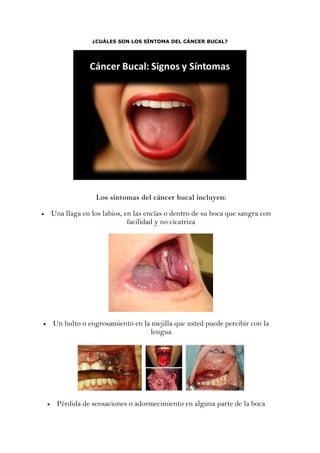 ¿CUÁLES SON LOS SÍNTOMA DEL CÁNCER BUCAL?
Los síntomas del cáncer bucal incluyen:
 Una llaga en los labios, en las encías o dentro de su boca que sangra con
facilidad y no cicatriza
 Un bulto o engrosamiento en la mejilla que usted puede percibir con la
lengua
 Pérdida de sensaciones o adormecimiento en alguna parte de la boca
 