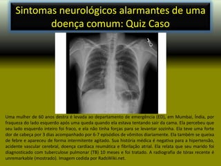 Sintomas neurológicos alarmantes de uma doença comum: Quiz Caso Uma mulher de 60 anos destra é levada ao departamento de emergência (ED), em Mumbai, Índia, por fraqueza do lado esquerdo após uma queda quando ela estava tentando sair da cama. Ela percebeu que seu lado esquerdo inteiro foi fraco, e ela não tinha forças para se levantar sozinha. Ela teve uma forte dor de cabeça por 3 dias acompanhado por 6-7 episódios de vômitos diariamente. Ela também se queixa de febre e apareceu de forma intermitente agitado. Sua história médica é negativa para a hipertensão, acidente vascular cerebral, doença cardíaca reumática e fibrilação atrial. Ela relata que seu marido foi diagnosticado com tuberculose pulmonar (TB) 10 meses e foi tratado. A radiografia de tórax recente é unremarkable (mostrado). Imagem cedida por RadsWiki.net. 