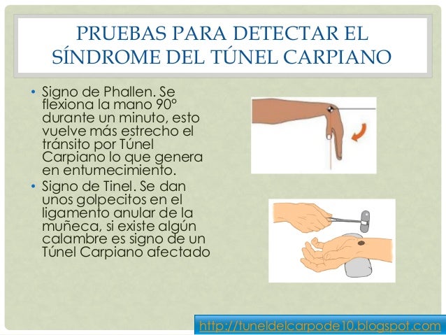 Después del estrés duele el cuello delante de