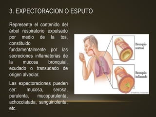 3. EXPECTORACION O ESPUTO
Represente el contenido del
árbol respiratorio expulsado
por medio de la tos,
constituido
fundamentalmente por las
secreciones inflamatorias de
la mucosa bronquial,
exudado o transudado de
origen alveolar.
Las expectoraciones pueden
ser: mucosa, serosa,
purulenta, mucopurulenta,
achocolatada, sanguinolenta,
etc.
 