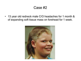Case #2
• 13 year old redneck male C/O headaches for 1 month &
of expanding soft tissue mass on forehead for 1 week.
 