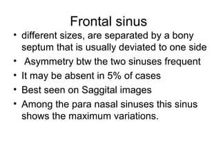 Frontal sinus
• different sizes, are separated by a bony
septum that is usually deviated to one side
• Asymmetry btw the two sinuses frequent
• It may be absent in 5% of cases
• Best seen on Saggital images
• Among the para nasal sinuses this sinus
shows the maximum variations.
 