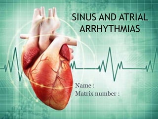 SINUS AND ATRIAL
ARRHYTHMIAS
Name :
Matrix number :
 
