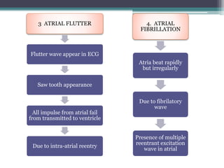 3 ATRIAL FLUTTER
Flutter wave appear in ECG
Saw tooth appearance
All impulse from atrial fail
from transmitted to ventricle
Due to intra-atrial reentry
4. ATRIAL
FIBRILLATION
Atria beat rapidly
but irregularly
Due to fibrilatory
wave
Presence of multiple
reentrant excitation
wave in atrial
 