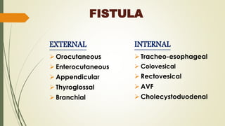 FISTULA
EXTERNAL
 Orocutaneous
 Enterocutaneous
 Appendicular
 Thyroglossal
 Branchial
INTERNAL
 Tracheo-esophageal
 Colovesical
 Rectovesical
 AVF
 Cholecystoduodenal
 