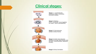Clinical stages:
 