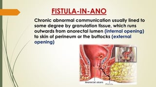 FISTULA-IN-ANO
Chronic abnormal communication usually lined to
some degree by granulation tissue, which runs
outwards from anorectal lumen (internal opening)
to skin of perineum or the buttocks (external
opening)
 
