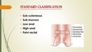 STANDARD CLASSIFICATION
 Sub cutaneous
 Sub mucous
 Low anal
 High anal
 Pelvi rectal
 