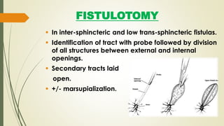 FISTULOTOMY
 In inter-sphincteric and low trans-sphincteric fistulas.
 Identification of tract with probe followed by division
of all structures between external and internal
openings.
 Secondary tracts laid
open.
 +/- marsupialization.
 
