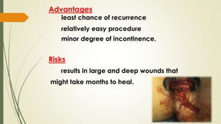 Advantages
least chance of recurrence
relatively easy procedure
minor degree of incontinence.
Risks
results in large and deep wounds that
might take months to heal.
 