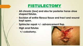 FISTULECTOMY
• All chronic (low) and also for posterior horse-shoe
shaped fistulas.
• Excision of entire fibrous tissue and tract and wound
kept open.
• Sphincter repair +/- advancement flap.
• High anal fistulas
+/-colostomy.
 