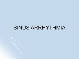 SINUS ARRHYTHMIA
 