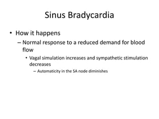 Sinus Bradycardia
• How it happens
  – Normal response to a reduced demand for blood
    flow
     • Vagal simulation increases and sympathetic stimulation
       decreases
        – Automaticity in the SA node diminishes
 