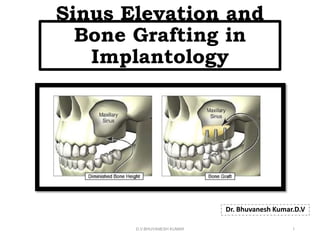 Sinus Elevation and
Bone Grafting in
Implantology
Dr. Bhuvanesh Kumar.D.V
D.V.BHUVANESH KUMAR 1
 
