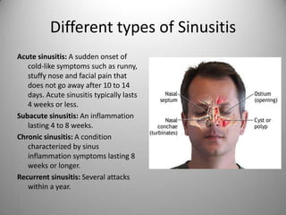 Different types of Sinusitis
Acute sinusitis: A sudden onset of
cold-like symptoms such as runny,
stuffy nose and facial pain that
does not go away after 10 to 14
days. Acute sinusitis typically lasts
4 weeks or less.
Subacute sinusitis: An inflammation
lasting 4 to 8 weeks.
Chronic sinusitis: A condition
characterized by sinus
inflammation symptoms lasting 8
weeks or longer.
Recurrent sinusitis: Several attacks
within a year.
 