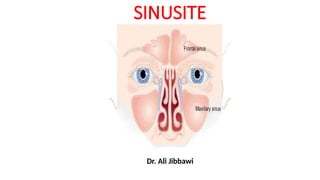 Comprehensive Overview of Sinusitis: Anatomy, Diagnosis, and Treatment ...