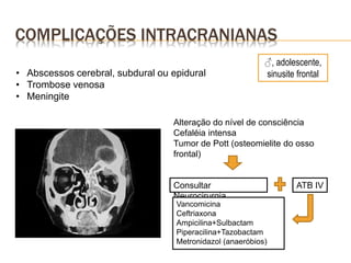 COMPLICAÇÕES INTRACRANIANAS
• Abscessos cerebral, subdural ou epidural
• Trombose venosa
• Meningite
♂, adolescente,
sinusite frontal
Alteração do nível de consciência
Cefaléia intensa
Tumor de Pott (osteomielite do osso
frontal)
Consultar
Neurocirurgia
ATB IV
Vancomicina
Ceftriaxona
Ampicilina+Sulbactam
Piperacilina+Tazobactam
Metronidazol (anaeróbios)
 