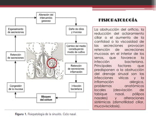FISIOPATOLOGÍA

La obstrucción del orificio, la
reducción del aclaramiento
ciliar o el aumento de la
cantidad o la viscosidad de
las secreciones provocan
retención    de      secreciones
mucosas en el interior de los
senos,    que     favorece       la
infección            bacteriana.
Principales    factores       que
predisponen a la obstrucción
del drenaje sinusal son las
infecciones     víricas     y    la
inflamación              alérgica,
problemas            anatómicos
locales     (desviación         de
tabique      nasal,        pólipos
nasales)     y       alteraciones
sistémicas (dismotilidad ciliar,
mucoviscidosis).
 