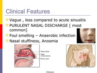 purulent nasal drainage