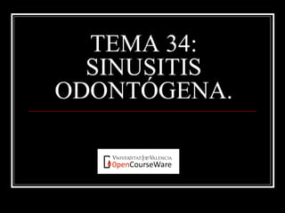 TEMA 34:
SINUSITIS
ODONTÓGENA.
 