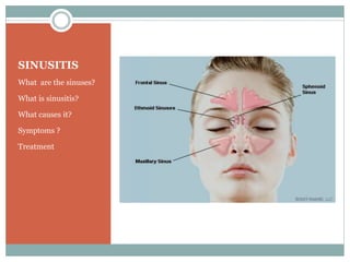SINUSITIS
What are the sinuses?
What is sinusitis?
What causes it?
Symptoms ?
Treatment
 
