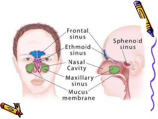 Sinusitis | PDF