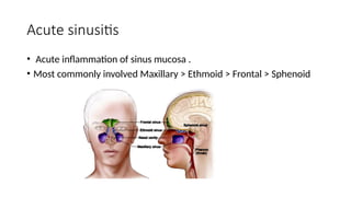 Comprehensive Overview of Sinusitis: Classification, Pathology, and ...