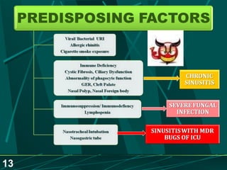 Sinusitis.. Dr.Prashant Modi