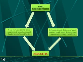 Sinusitis.. Dr.Prashant Modi