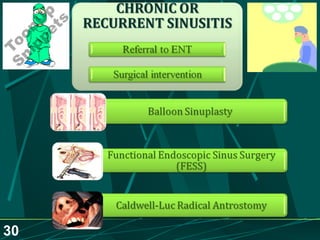 Sinusitis.. Dr.Prashant Modi