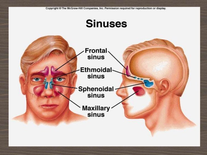sinusitis 1