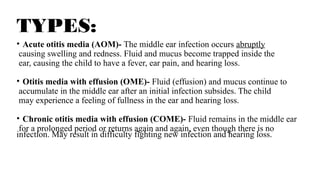 sinusitis 123.pptx department of physiotherapy | PPTX